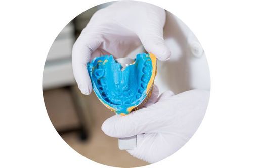 dental-impression-circle.jpg