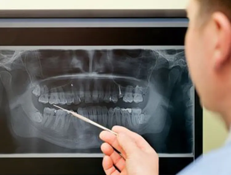 Radiation Exposure Comparison