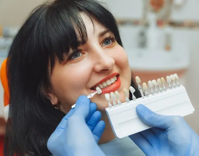 Teeth whitening (part 2)