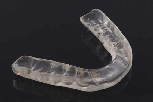 occlusal-splint.jpg