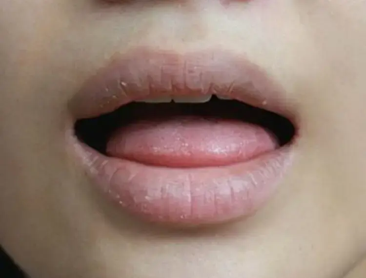 dry-mouth-500x400_jpg_350.webp