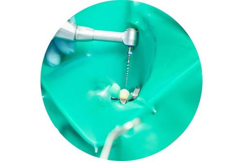 isolated-tooth-circle.jpg