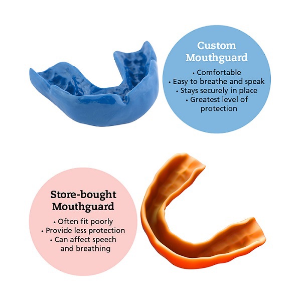 mouthguards.jpg